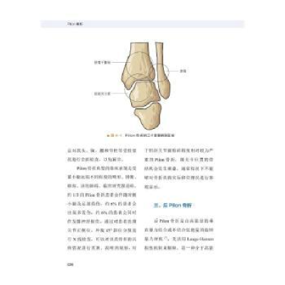 诺森Pilon骨折李钊伟,李泽清9787500986中国科学技术出版社