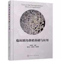 诺森临床胰岛移植基础与应用刘成洋主编9787122828化学工业出版社