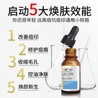 男士面膜补水控油痘印祛痘祛斑保湿去黑头收缩毛孔变增白 面膜20片+祛痘原液15ml