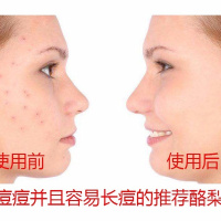 酪梨洗面奶 茉莉洗面奶 孕妇可用 祛痘 补水控油 洁面 学生 100克 一盒（赠洗脸扑1）