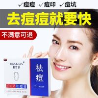 恒雪倩祛痘套装2合一 去痘痘洗面奶女祛痘膏青春痘学生祛痘产品补水男士护肤品套装