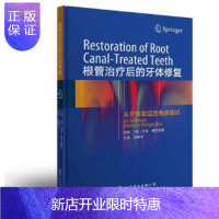 惠典正版正版 根管治疗后的牙体修复 现代牙齿根管治疗技术口腔临床操作技术矫正美白美学修复 口腔医学书籍
