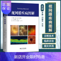 惠典正版正版书籍 视网膜疾病图解 适于眼科、急诊、神经内科等专业的临床医师和验光师阅读使用 山东