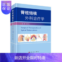 惠典正版正版 脊柱结核外科治疗学 化疗时代脊柱结核的治疗 脊柱结核外科治疗概述 脊柱结核的手术治疗 石仕元