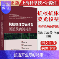 惠典正版抗核抗体荧光核型图谱及病例判读 郑冰 吕良敬 李敏 上海科学技术出版社