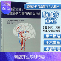 惠典正版脑血管重建:显微外科与血管内介入技术