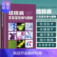 惠典正版结核病实验室检测与图解 卢洪洲 等编门 专门介绍目前结核病检测技术关键细节 操作注意事项 上海科学
