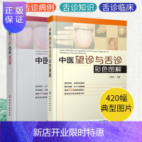 惠典正版 中医舌诊临床图解+中医望诊与舌诊彩色图解 400余幅典型舌象图 手诊面诊舌诊辩证图谱