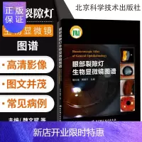 惠典正版正版 眼部裂隙灯生物显微镜图谱 眼科多发病的治疗与鉴别诊断技术书籍 眼科学临床医学疾病在裂隙灯检查