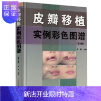 惠典正版皮瓣移植实例彩色图谱(第2版)头部颜面部及四肢部组织缺损与畸形的皮瓣修复 临床医学