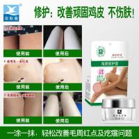 去鸡皮肤疙瘩毛囊角质大腿鱼鳞蛇干燥脱皮毛周角化身体乳保湿6