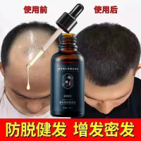 南京育发液 []防脱育发液秃头密发胡须增发液护发修护发根精华液