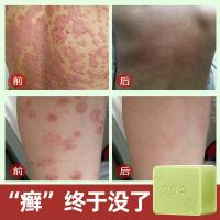 [新品]去癣净肤皂止痒去皮屑脱屑癣全身深层清洁香皂