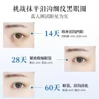 通用活力紧致保湿眼霜 120秒急救补水修护寡肽-1眼霜