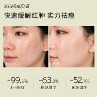 15 祛痘精华液面部保湿修护痘印清洁毛孔收缩精华液