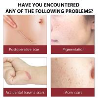 鳄鱼油精华液30肌肤