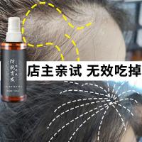 剂增发密发头发增长液脂溢性秃顶快速变长发防脱发洗发水