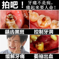 虫牙牙洞药蛀牙去除黑黑斑虫牙蛀牙龋齿清理蛀牙牙洞蛀牙药杀蛀虫治牙疼