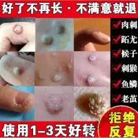 去猴子的yao祛刺猴去除修子去猴子肉粒疙瘩手足部脚肉刺去除膏鱼鳞痣贴