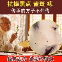 去痣点痣无痕薬水点痣薬水点痣水去痣祛黑痣非笔修复膏无痕水脸部仪 一盒装(送牙签)