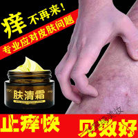 屁股痒皮肤瘙痒私处止痒膏大腿内侧肛屁眼痒屁股囊潮湿皮癬过敏膏