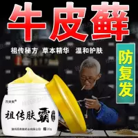 牛皮屑专用薬膏 顽固藓薬膏断根软膏顽固外用薬克星真菌感染湿疹专用