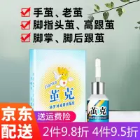 茧克去除脚底老茧神器死皮膏祛除足脚趾关节茧子软化剂
