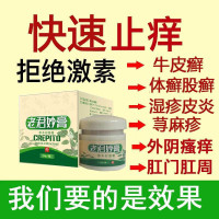 老君妙膏私处止痒膏肛肛周外痒牛皮皮荨麻膏