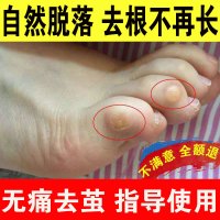 去手上死皮去脚底后跟脚趾头上老茧硬死皮老茧贴去除膏软化剂脚垫手足部