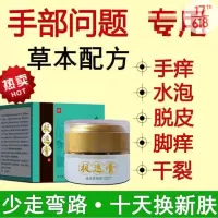[优选]手痒脱皮水泡掌心干裂水泥手指头烂瘙痒手藓手气止痒膏反复