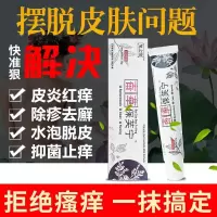 手癣膏手足癣真菌感染脱皮干裂水泡湿红疹皮肤夫病止痒真菌感染鹅掌风牛皮鲜癣软膏股癣大腿内侧疥疮膏寒水堂