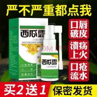 口腔溃疡喷剂复发性口疮西瓜霜起泡上火慢性咽炎喷剂咽喉喷雾