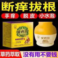 手脱皮修复霜手上痒起小水泡脱皮干裂修复霜止痒膏瘙痒外用皮脱皮季节性