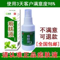 蛇盘疮胆疮缠腰蛇佰带状百疱泡疹清蛇斑癍疮拔毒后遗症祛痛液