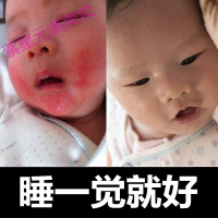 婴儿宝湿疹膏湿疹婴儿无婴宝湿疹霜婴幼儿儿儿童去奶癣止痒膏面霜