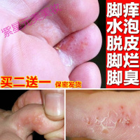 脚去脚汗根粉克星防鞋袜子异味酸臭味去真菌泡脚药包