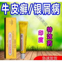 牛皮屑专用薬银灵印度专用手足藓止痒瘙痒过敏性皮炎湿疹疥疮膏