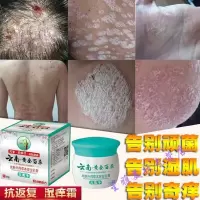 老中癣根手气手干脱皮膏手痒脱皮干裂手上干燥起皮小水泡止痒膏汗孢疹手气季节性反复膏