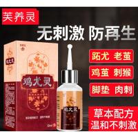 鸡尤灵鸡尤康止尤净鸡尤净跖疣净去老茧手足部脚底趾疣扁平优寻常疣