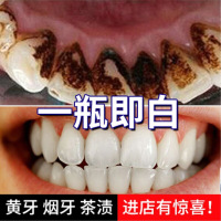 贝酶町洁牙素仁诺百邦洁牙素贝酶町 竹炭洁牙粉 去除烟渍牙垢