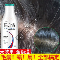 去屑止痒去屑止痒洗发水头皮癬头痒去真菌头皮屑克星去头屑药
