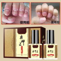 灰甲国易而康脱甲外严膏液林甲本林甲益康舒邦钾甲尔康灵套装灰指甲不包扎不修甲非灰指甲膏