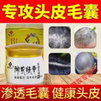 头皮毛囊1炎专用脂溢1性皮炎头背部脓包祛痘红疹瘙痒膏