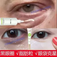 [正常发货]眼霜去细纹 眼袋 黑眼圈 祛脂肪粒 鱼尾纹 保湿补水提拉紧致抗眼纹眼部男女士精华30g