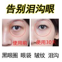 祛除泪沟眼去黑眼圈眼袋眼睛护理填充眼窝丰泪沟卧蚕精华男女