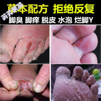 脚医生脚立净足醋液非世云堂竹醋液世云堂竹醋液小绿瓶牌喷剂止痒脱皮水泡型糜烂脚臭膏鞋臭