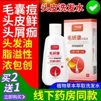 毛妍康头皮毛囊炎痘痘头皮癣洗发水脂溢性头癣头皮屑疙瘩