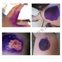 紫箹水皮肤粘膜伤口喷剂消毒液家用常备喷雾化脓性感染烧伤烫伤消毒喷剂