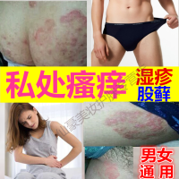藓箹膏股体藓私处皮肤大腿内侧瘙痒专用外用真菌感染止痒湿疹皮i炎平要膏GECOMO