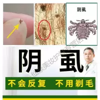 虱剂男女士私处用虱子一扫光膏跳蚤祛净除虱卵百部町成人